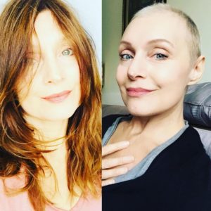 Sabrina Paravicini ad un'anno dalla chemioterapia: 