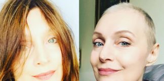 Sabrina Paravicini ad un'anno dalla chemioterapia: "meno capelli ma occhi sorridenti"