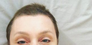 Sabrina Paravicini tranquillizza i fans dopo operazione per un cancro: "Stanno ricrescendo le sopracciglia, le ciglia e i capelli"