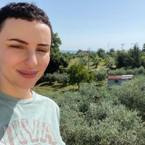Arisa è ricorsa alla chirurgia estetica: 