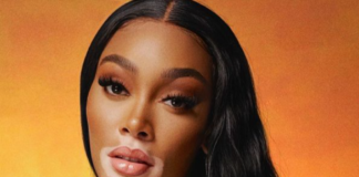 Winnie Harlow biografia: chi è, età, altezza, peso, figli, marito, vitiligine, Instagram e vita privata