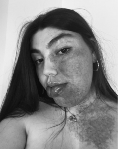 Martina Dinelli biografia: chi è, età, altezza, peso, fidanzato, Angioma, Instagram, TikTok e vita privata