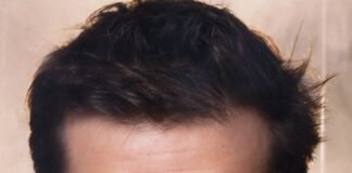 Grégory Fitoussi biografia: chi è, età, altezza, peso, figli, moglie, carriera, Instagram e vita privata