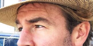 Che malattia ha l'attore James Van Der Beek?