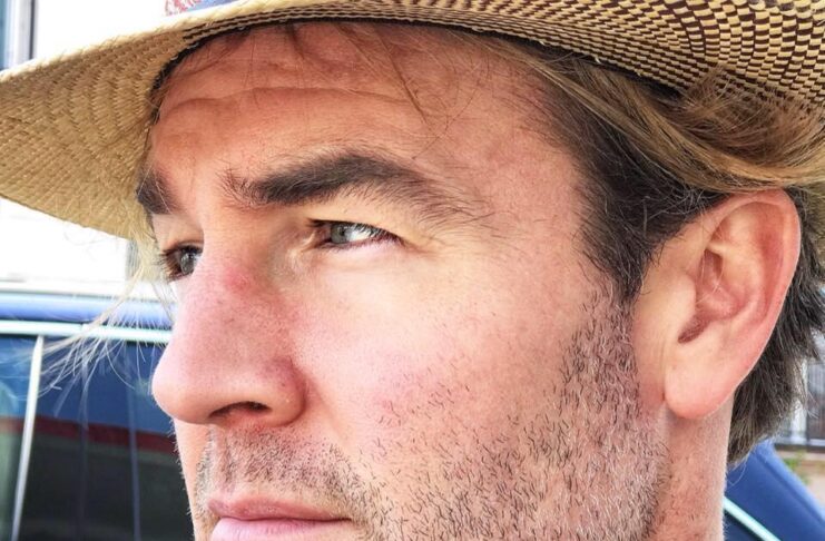 Che malattia ha l'attore James Van Der Beek?