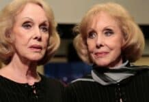 Le Gemelle Kessler chi erano? Biografia completa, carriera, vita privata, eredità, data e cause della morte Le Gemelle Kessler chi erano