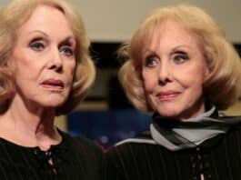 Le Gemelle Kessler chi erano