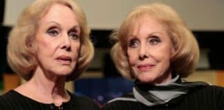 Le Gemelle Kessler chi erano