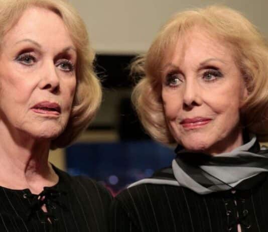 Le Gemelle Kessler chi erano