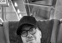 Il cantante Raf ha fatto il trapianto di capelli?